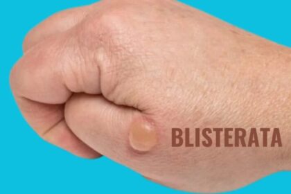 https://uktimepost.com/when-is-the-best-time-to-use-blisterata/