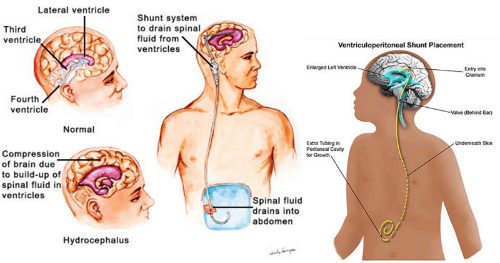 How to Navigate Shunt.com Effectively